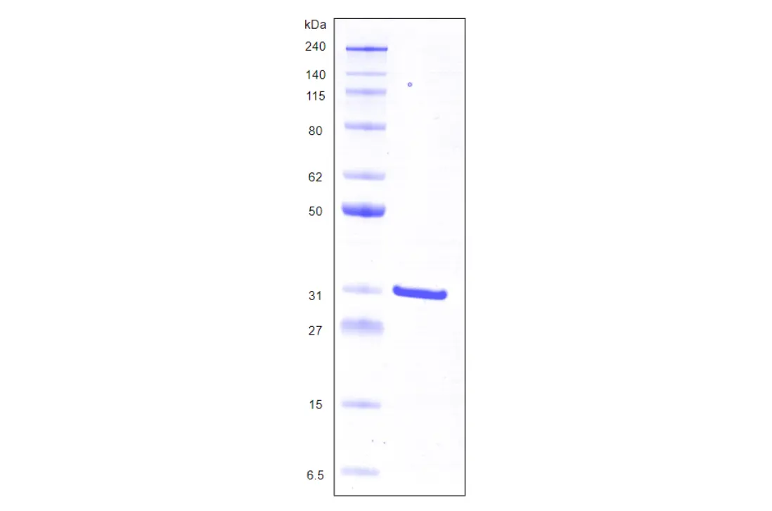 Recombinant Human Galectin 3, His Tag -100 ug